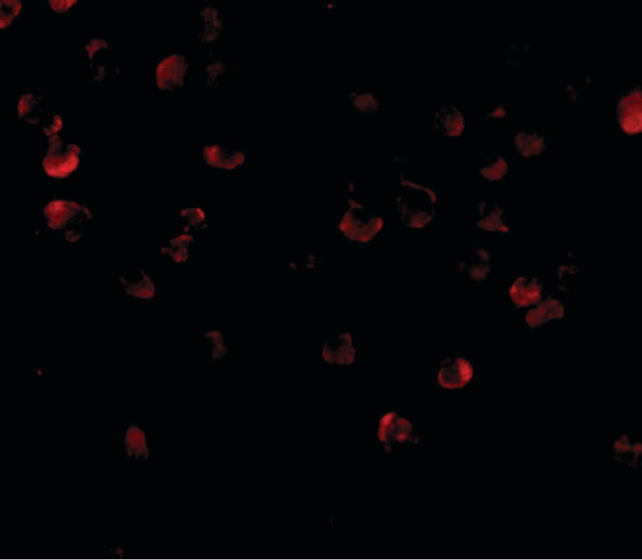 ADAP / FYB Antibody