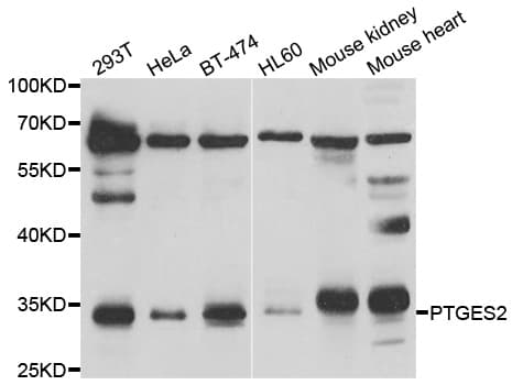 IHC-plus™ PTGES2 Antibody