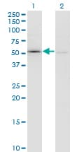 Monoclonal Mouse anti-Human F11 / FXI / Factor XI Antibody (clone 2H8, WB)
