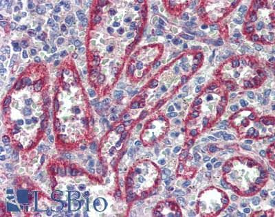IHC-plus™ LAMB2 / Laminin Beta 2 Antibody (aa1579-1798)