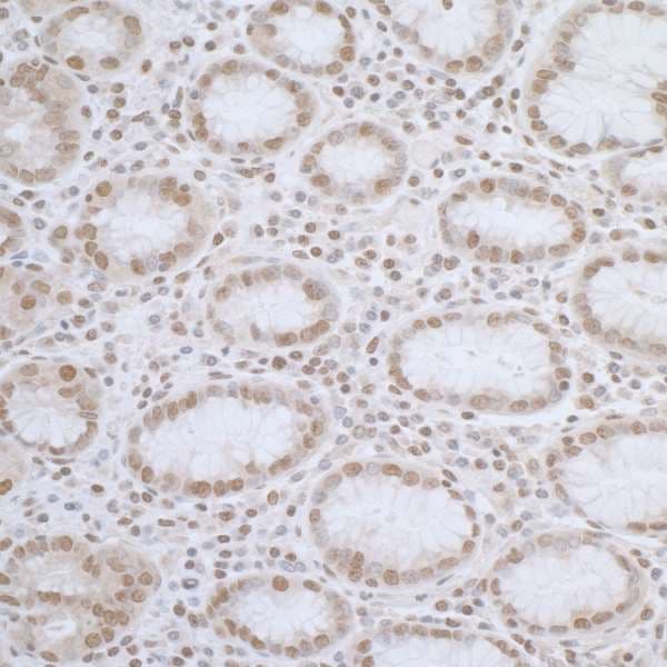 ELAC2 Antibody (aa150-200)