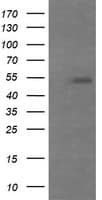 MDM4 / MDMX Antibody (clone OTI4B5)