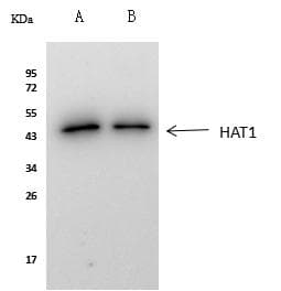 HAT1 Antibody (Preservative Free)