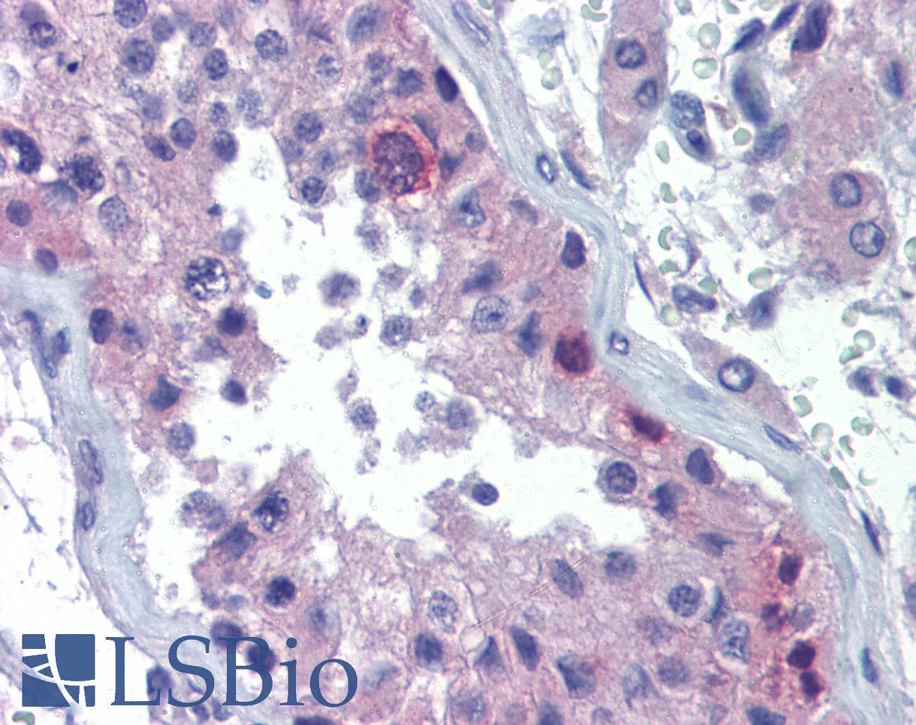 RHOXF2 Antibody (aa108-157)