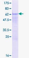 Human SFRS7 / 9G8 Protein (Recombinant GST)