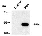 TPH1 / Tryptophan Hydroxylase Antibody (phospho-Ser58)