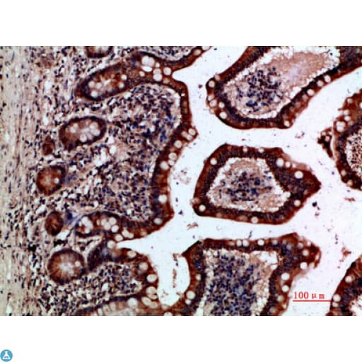 GREM2 / Gremlin 2 Antibody