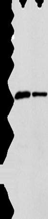 APOL2 / Apolipoprotein L 2 Antibody