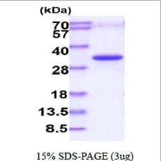 Human PHOSPHO1 Protein (Recombinant His)
