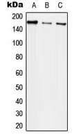IHC-plus™ EGFR Antibody (Internal)