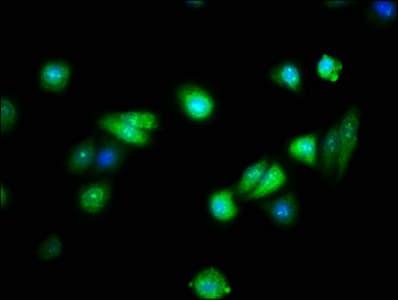 Polyclonal Rabbit anti-Human FAIM Antibody (WB)