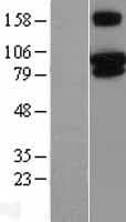 TRPV3 Protein (Over-Expression Lysate Myc-DDK (Flag))