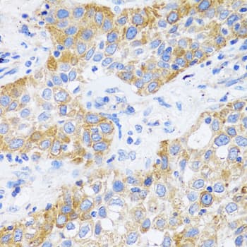 CD71 / Transferrin Receptor Antibody