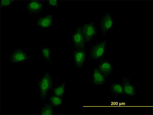 Monoclonal Mouse anti-Human ARID1B / BAF250B Antibody (clone 2F2, IHC, IF, WB)