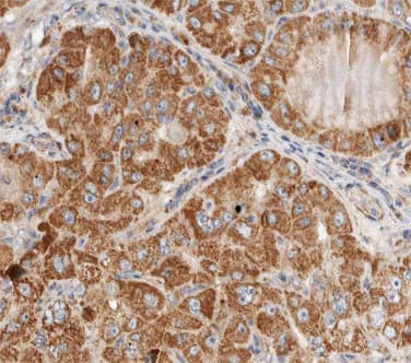 ACTB / Beta Actin Antibody