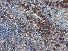 UBE2J1 Antibody (clone OTI1F6)