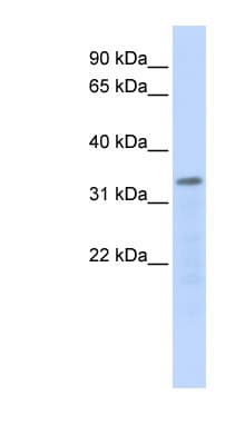 POLR3F Antibody (aa180-229)
