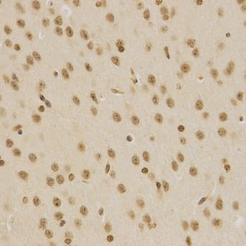Polyclonal Rabbit anti-Human BMI1 / PCGF4 Antibody (IHC, IF, WB)