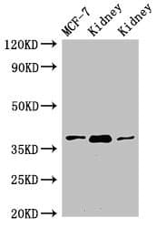 Polyclonal Rabbit anti-Human HAO2 Antibody (IHC, WB)