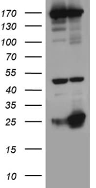 NK1 / CD160 Antibody (aa1-160, clone OTI2G2)