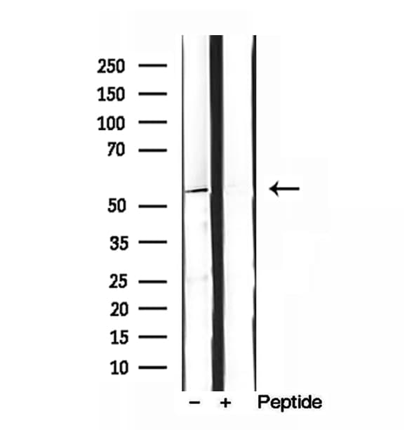 Polyclonal Rabbit anti-Human SKAP2 / SCAP2 Antibody (IHC, IF, WB)