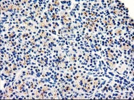 Monoclonal Mouse anti-Human Dipeptidylpeptidase 10 / DPP10 Antibody (clone OTI2A5, IHC, WB)