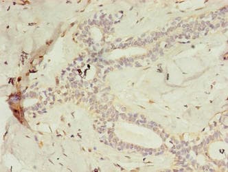Polyclonal Rabbit anti-Human C2orf47 Antibody (IHC, WB)