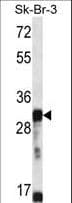 OR5D13 Antibody (aa172-199)