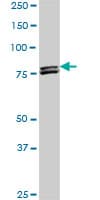 Monoclonal Mouse anti-Human MTA1 Antibody (clone 4D5, WB)