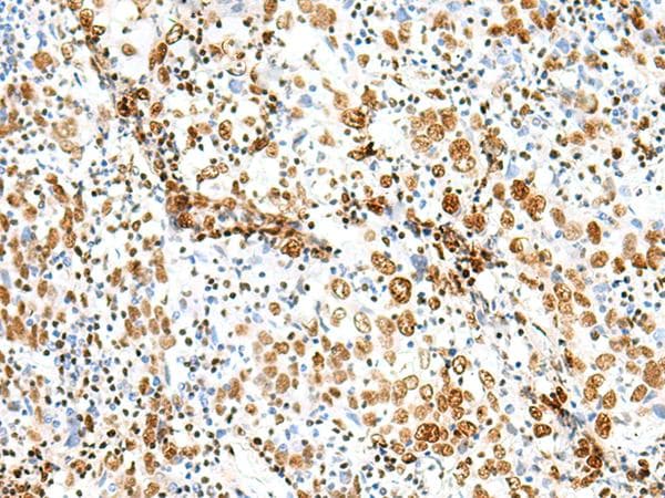Treacle / TCOF1 Antibody