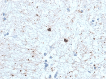 Ubiquitin Antibody (clone UBB/1748)