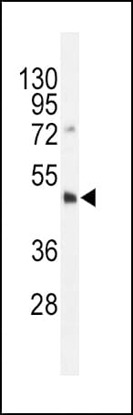 DNMT3L Antibody (aa357-388)