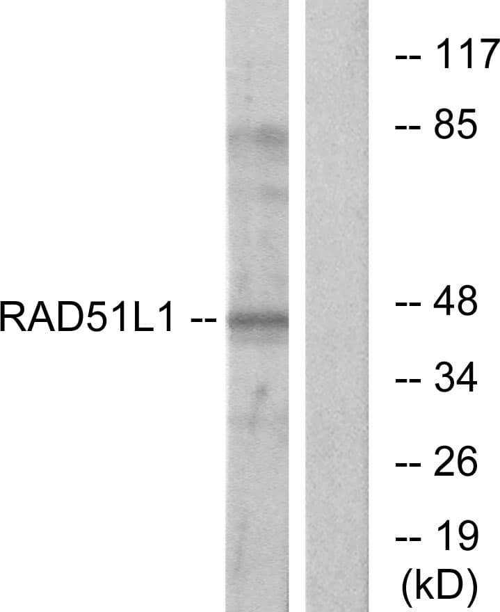 Polyclonal Rabbit anti-Human RAD51B Antibody (aa201-250, IHC, WB)