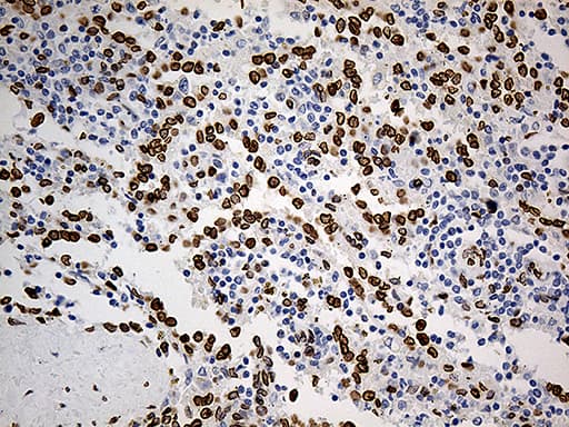 Monoclonal Mouse anti-Human SLU7 / 9G8 Antibody (clone OTI5A7, aa1-300, IHC, WB)