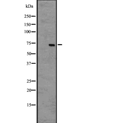 Polyclonal Rabbit anti-Human ALAS1 Antibody (IF, WB)