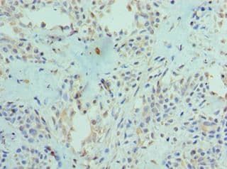 PADI4 / PAD4 Antibody (aa1-250)