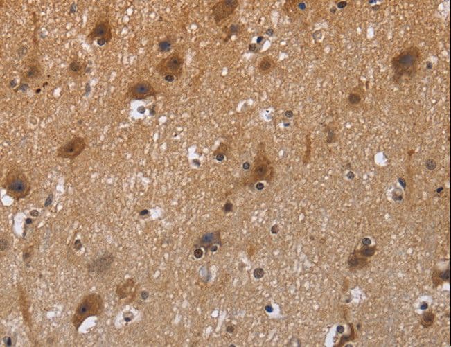 Polyclonal Rabbit anti-Human FSTL1 Antibody (IHC)