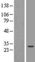 RAP30 / GTF2F2 Protein (Over-Expression Lysate Myc-DDK (Flag))