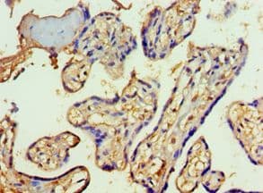 SF3B130 / SF3B3 Antibody (aa948-1217)