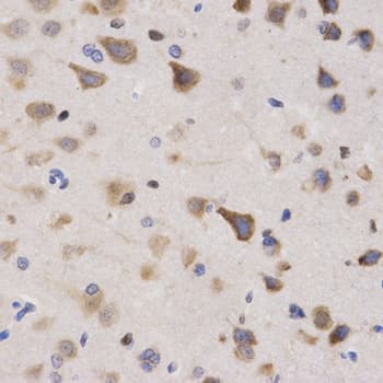 QIP1 / KPNA4 Antibody