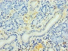 IHC-plus™ PDGF-D Antibody (aa191-370)