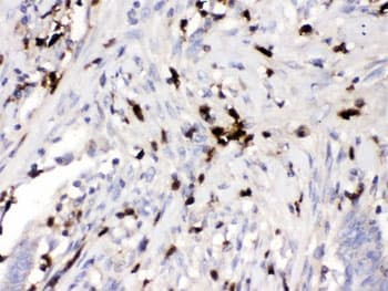 ORM1 / Orosomucoid Antibody