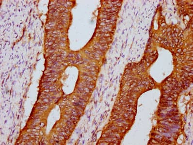 PKD1 / Polycystin Antibody