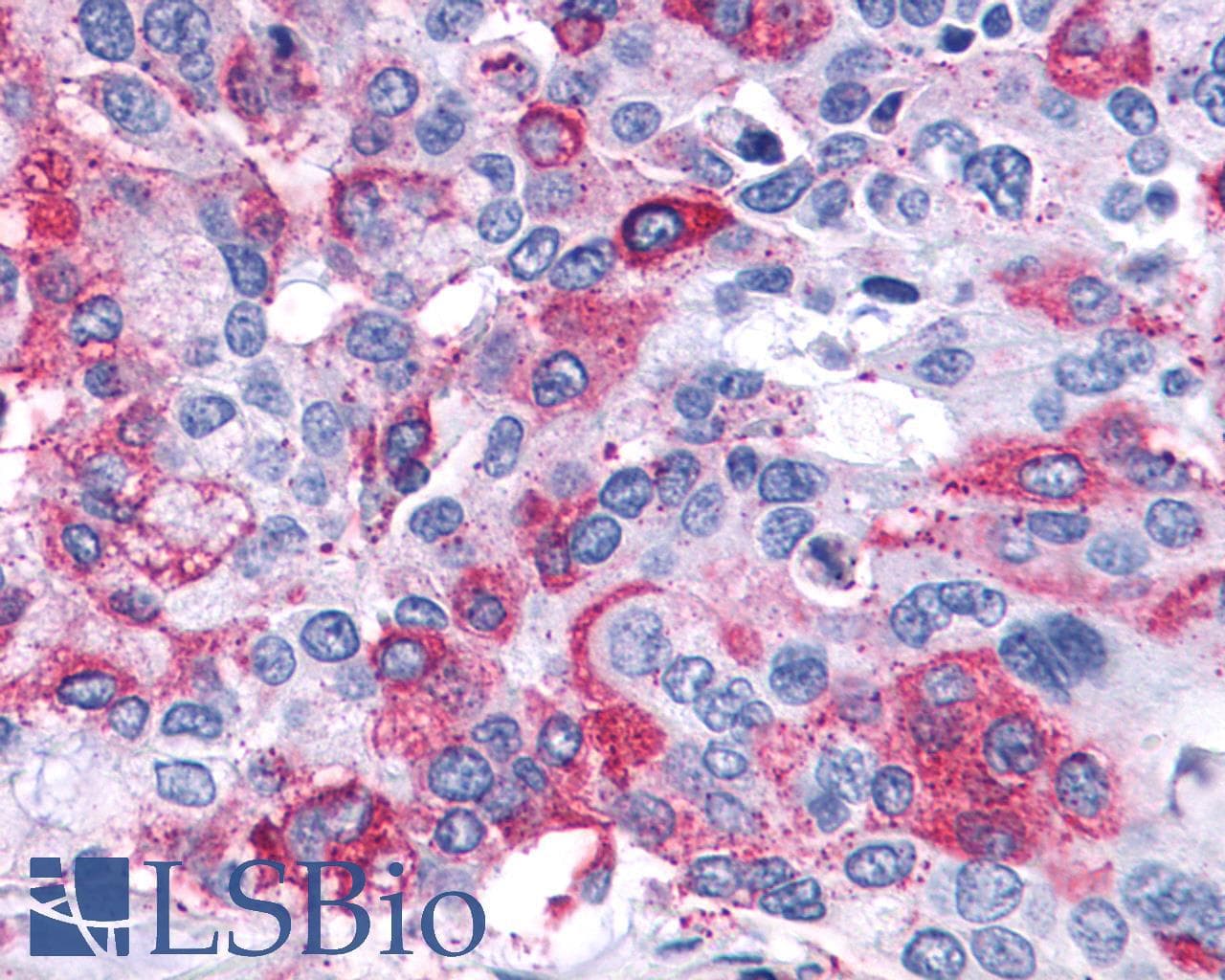 PathPlus™ LTB4R2 / BLT2 Antibody (Cytoplasmic Domain)