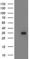 Monoclonal Mouse anti-Human LACTB2 Antibody (clone OTI1A4, WB)