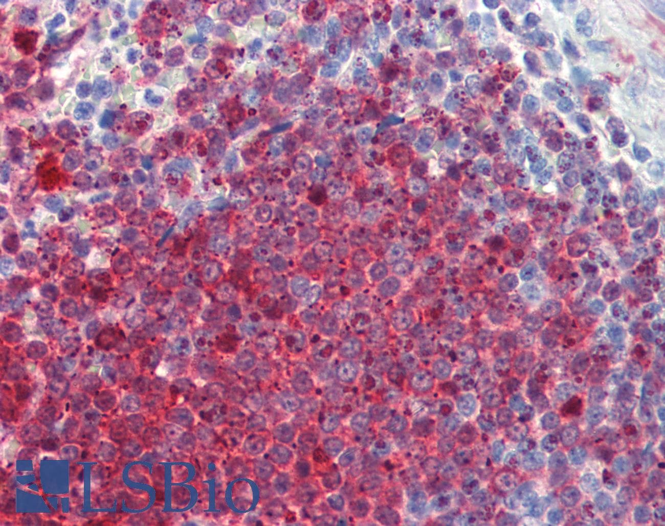 IHC-plus™ Polyclonal Rabbit anti-Human PIGY Antibody (IHC, IF, WB)