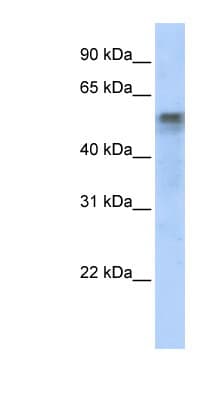 Polyclonal Rabbit anti-Human IRF6 Antibody (aa395-444, WB)