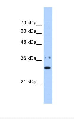 NMNAT1 / NMNAT Antibody (aa50-99)