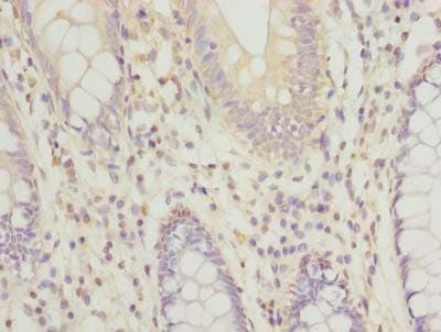 Polyclonal Rabbit anti-Human RPRD1B Antibody (IHC, WB)