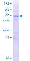 Human UNKL Protein (Recombinant GST)